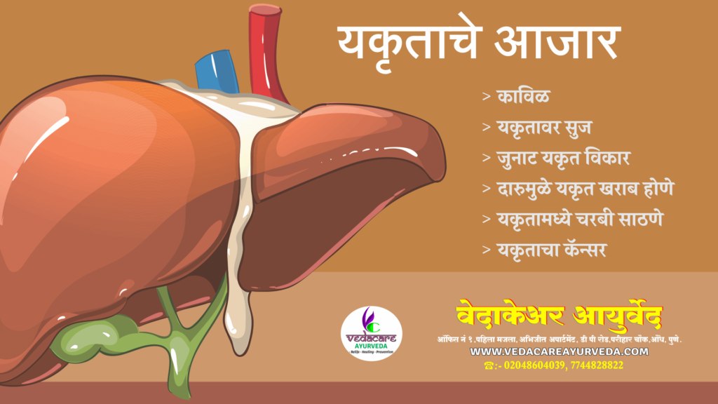 ayurvedic medicine for liver-लिवर रोग