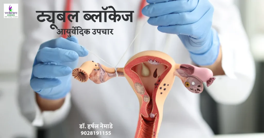 tubal blockage 1 drharshalnemade ayurved upachar