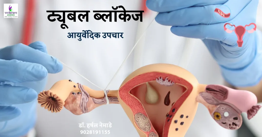 tubal blockage 1 drharshalnemade ayurved upachar