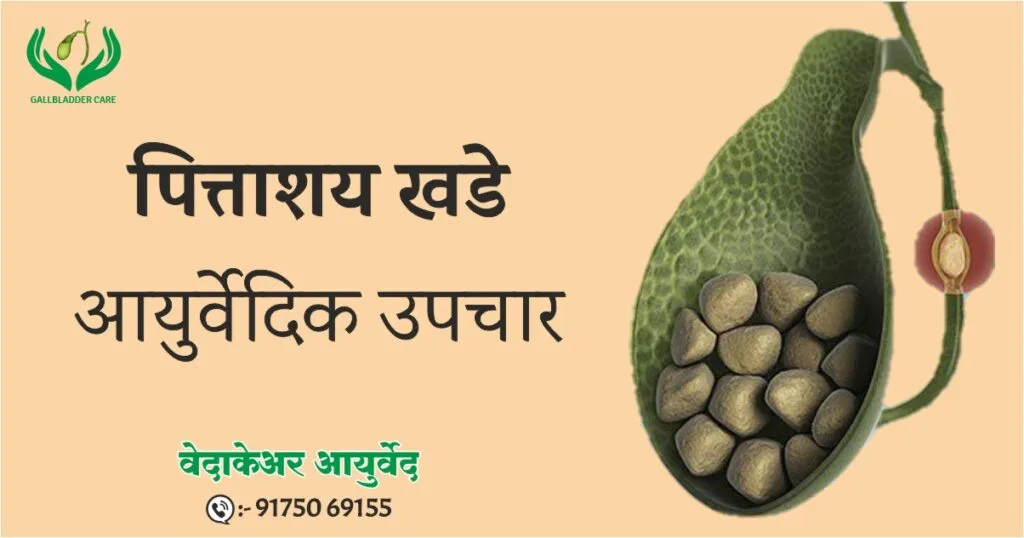 पित्ताशय खडे – आयुर्वेदिक औषधे व पंचकर्म थेरपी