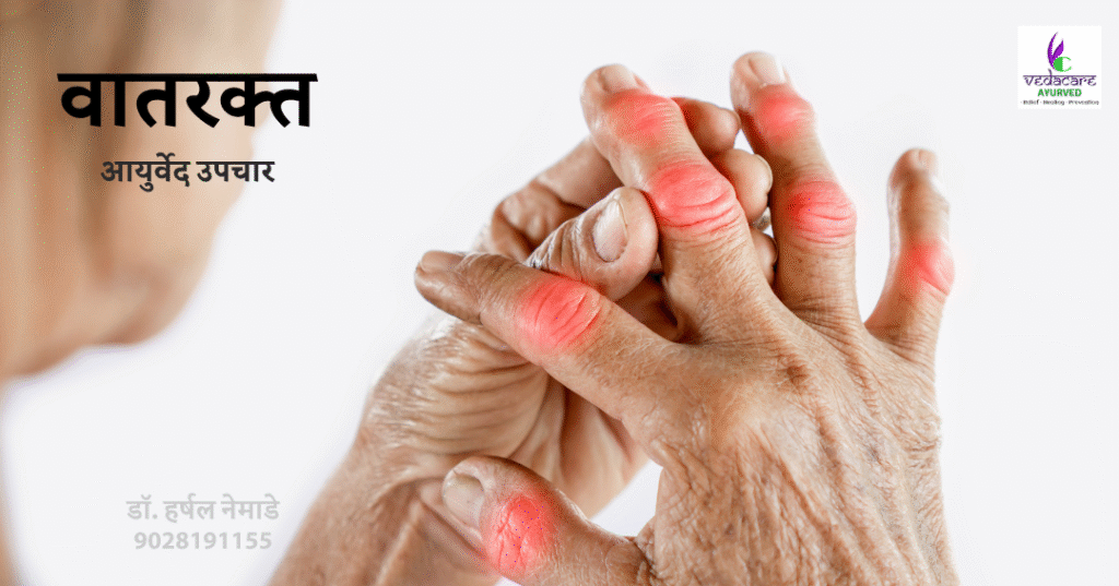 gout, vatrakta, bot sujane , uric acid